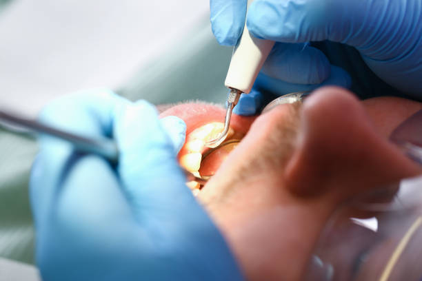Best Emergency Dental Surgery in China Spring, TX