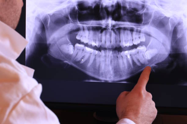 Best Emergency Root Canal Treatment in China Spring, TX