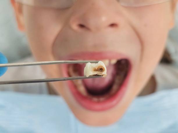 Best Emergency Dental Care for Trauma or Injury in China Spring, TX