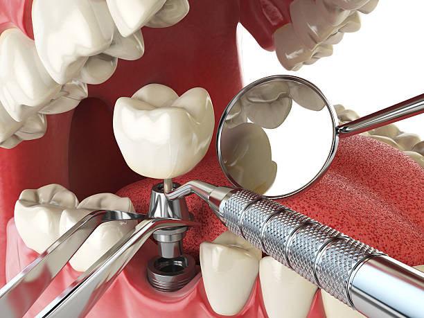 Best Pediatric Emergency Dentist in China Spring, TX